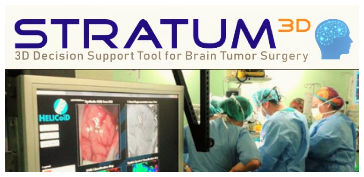 Avances en Neurocirugía: El Proyecto STRATUM!